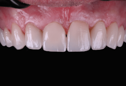 After - Wensleydale Dental