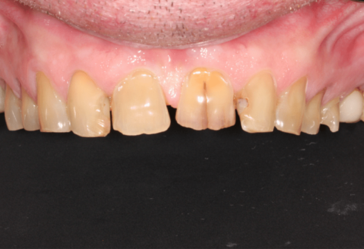 Before - Wensleydale Dental