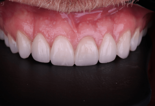 After - Wensleydale Dental