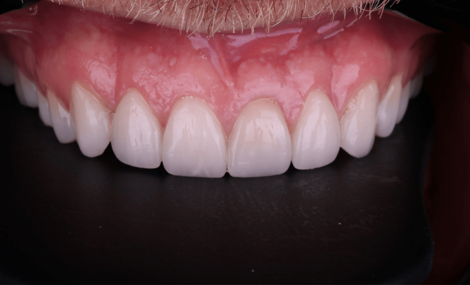 After - Wensleydale Dental Practice