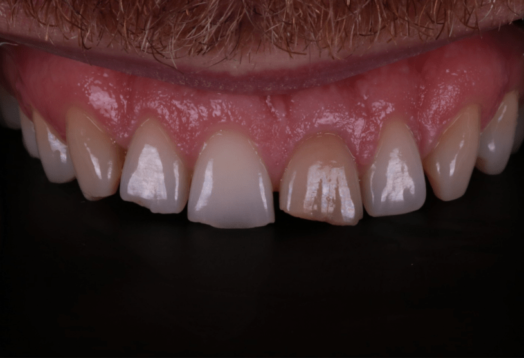 Before - Wensleydale Dental