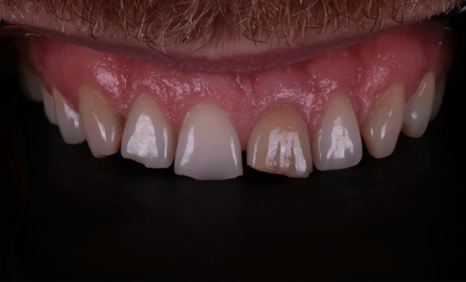 Smile Gallery Wensleydale Dental Practice Dentist in Huntingdon