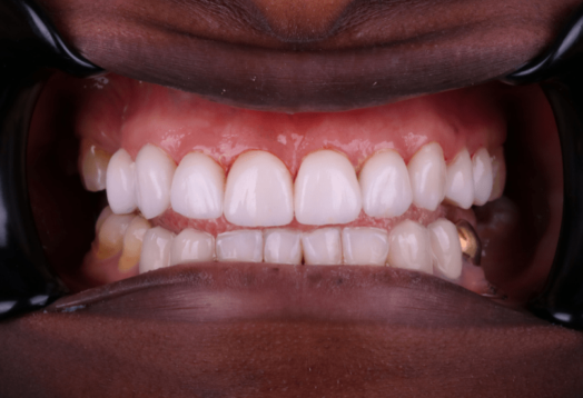 After - Wensleydale Dental