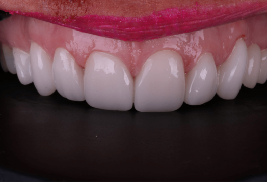 After - Wensleydale Dental