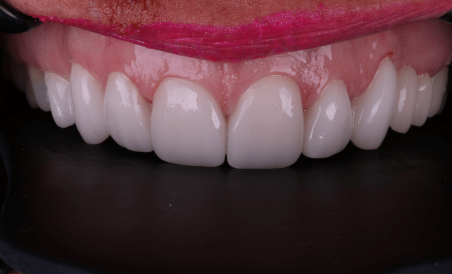 After - Wensleydale Dental Practice