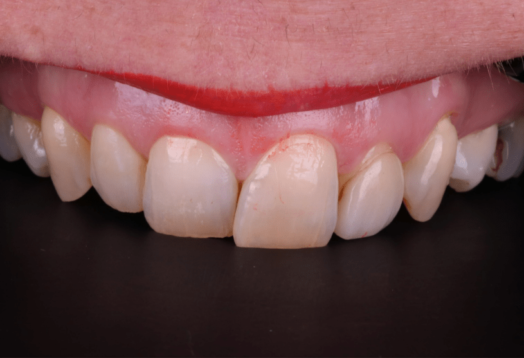 Before - Wensleydale Dental